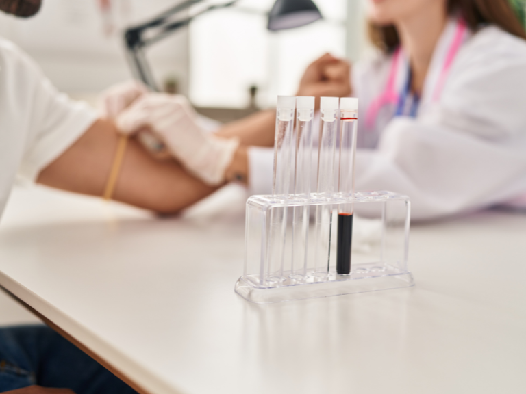 Pruebas genéticas para la fibrosis pulmonar